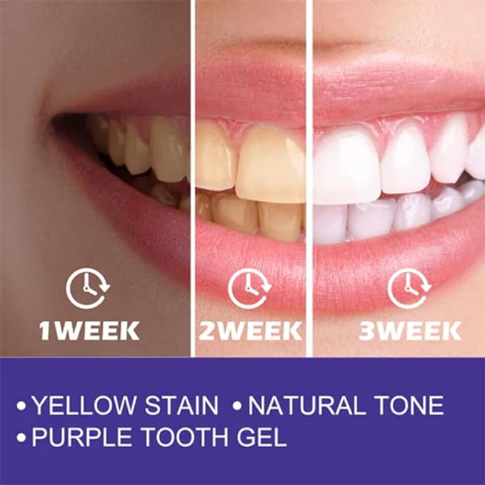 Purple Whitening Toothpaste™